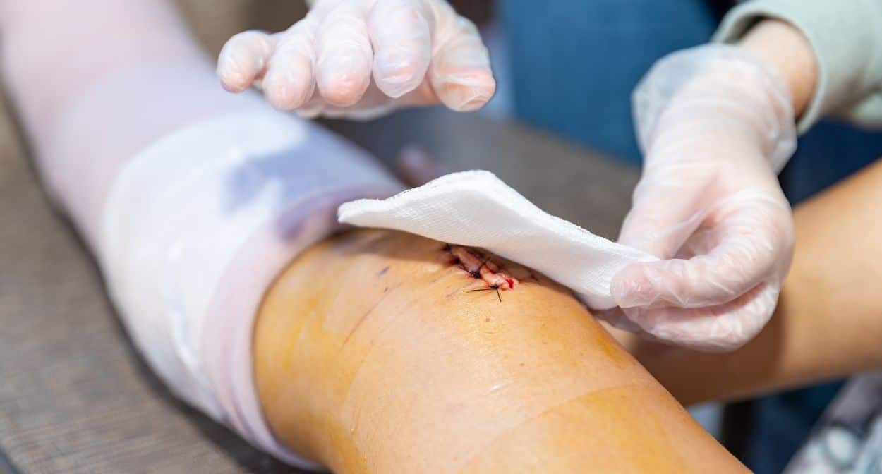 Understanding Different Types of Wounds